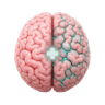 Stroke Technology